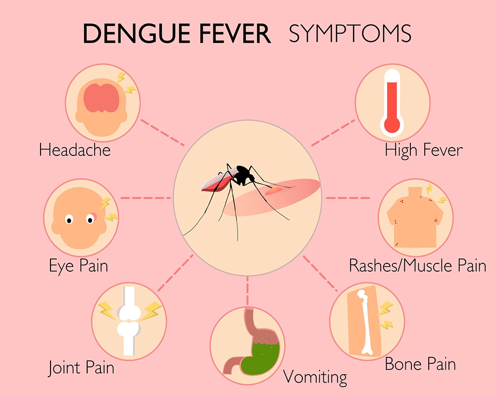 Dengue Fever in Adults