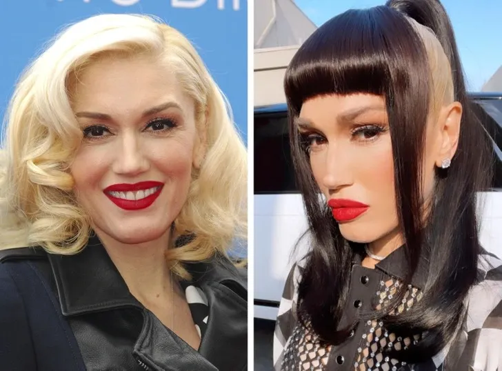 Most Drastic Celebrity Transformations